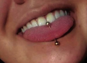 Tongue ring