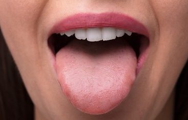 Close up of a healthy tongue