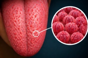 close up of the bumps on tongue  called fungiform papillae